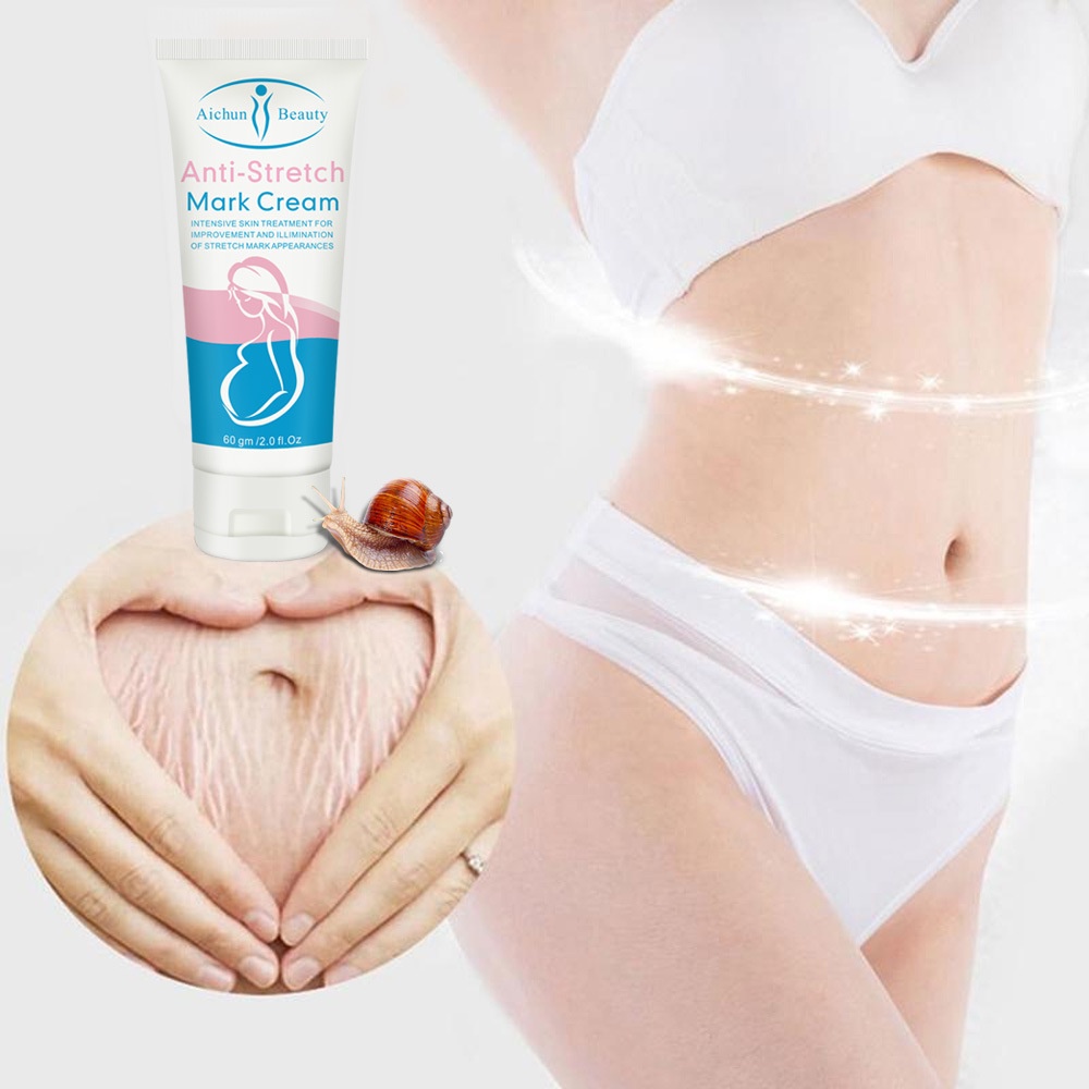 Kem Làm Mờ Rạn Da, Kem Tái Tạo Da Hiệu Quả Cho Bà Bầu Anti Stretch Marks Cream - Giảm Nhăn Do Tăng Cân Hiệu Quả
