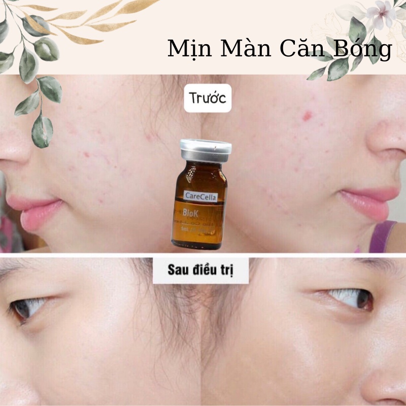 Serum Tế Bào Gốc Tái Tạo Da CARECELLA trắng da, chăm sóc da mờ thâm, se khít lỗ chân lông NHẬP KHẨU HÀN QUỐC