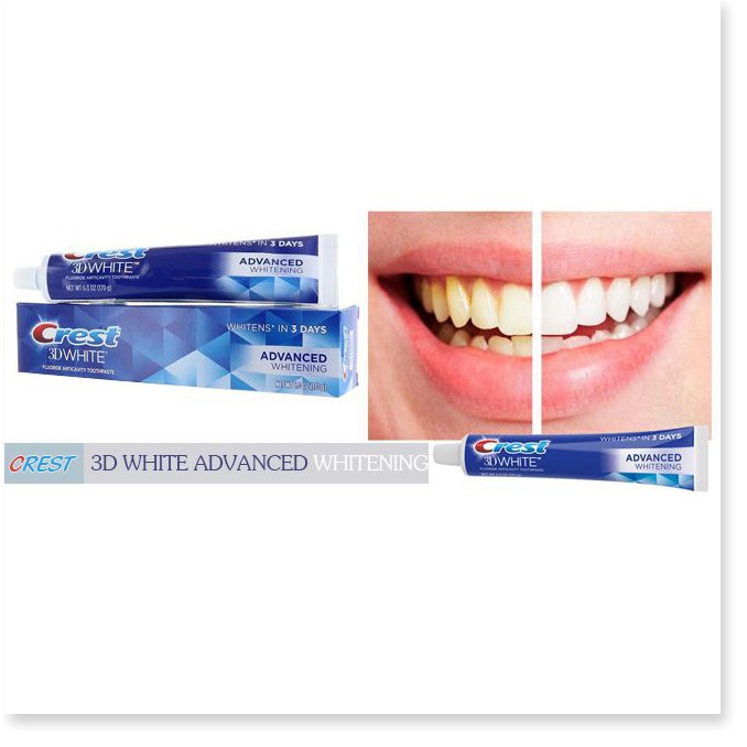 [Mã chiết khấu giảm giá mỹ phẩm sỉ chính hãng] Kem Đánh Răng Crest 3D White Advanced Whitening 158g