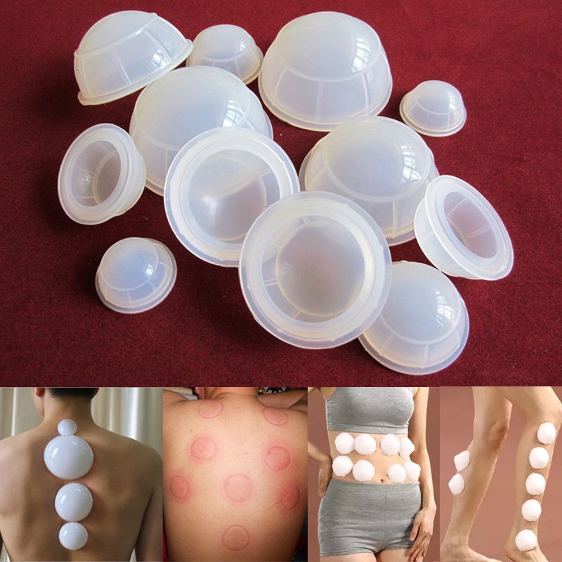 [Hàng mới về] Set dụng cụ giác hơi bằng silicon