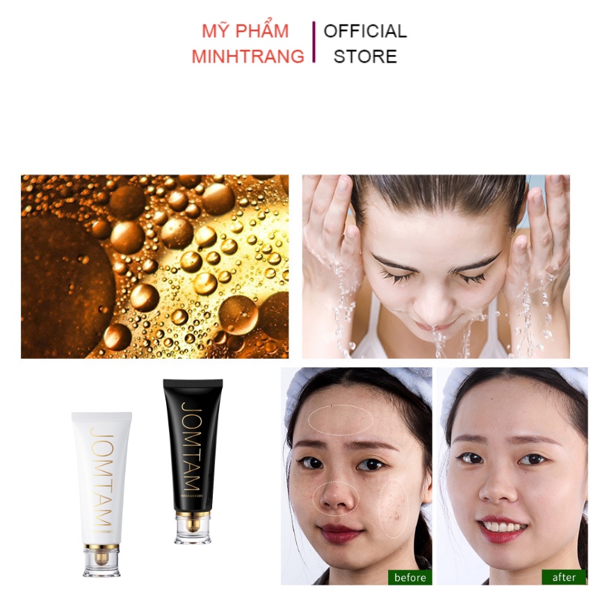 Sữa rửa mặt Jomtam 100g Acid Clear Muscle Cleanser sạch nhẹ nhàng bụi bẩn,ngăn ngừa mụn,giúp da trắng sáng,khỏe mạnh