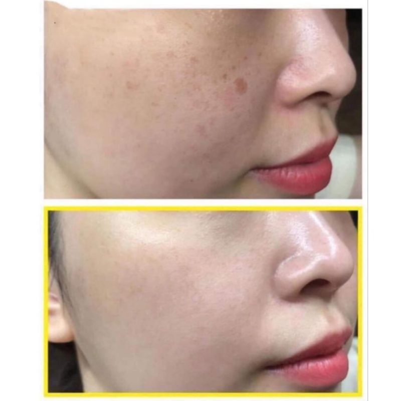 Serum dưỡng trắng Niacinamide 20% Lumiderm