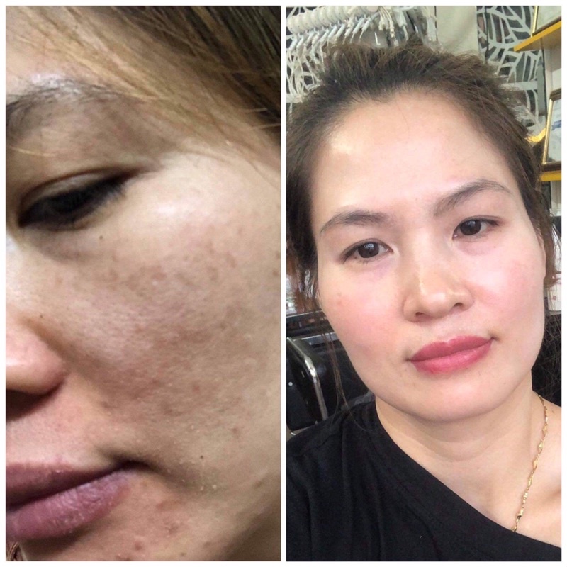 Hộp Huna Royal White trắng da mờ nám, ổn định nội tiết, chống lão hoá da