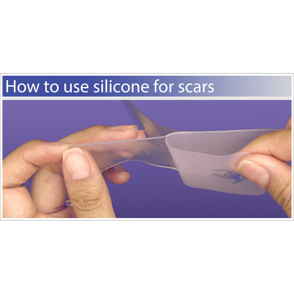 [SaigonScent] Miếng Dán Giảm Sẹo ScarAway Silicone Scar Sheets (8 miếng)