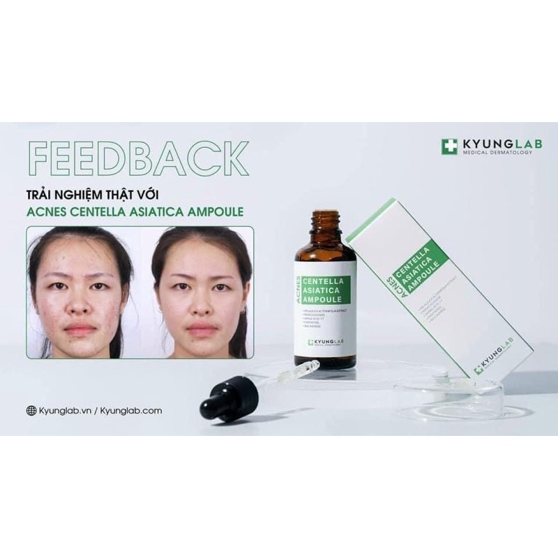 Tinh chất serum giảm mụn, ngừa mụn KYUNG LAB ACNES CENTELLA ASIATICA AMPOULE 50ml