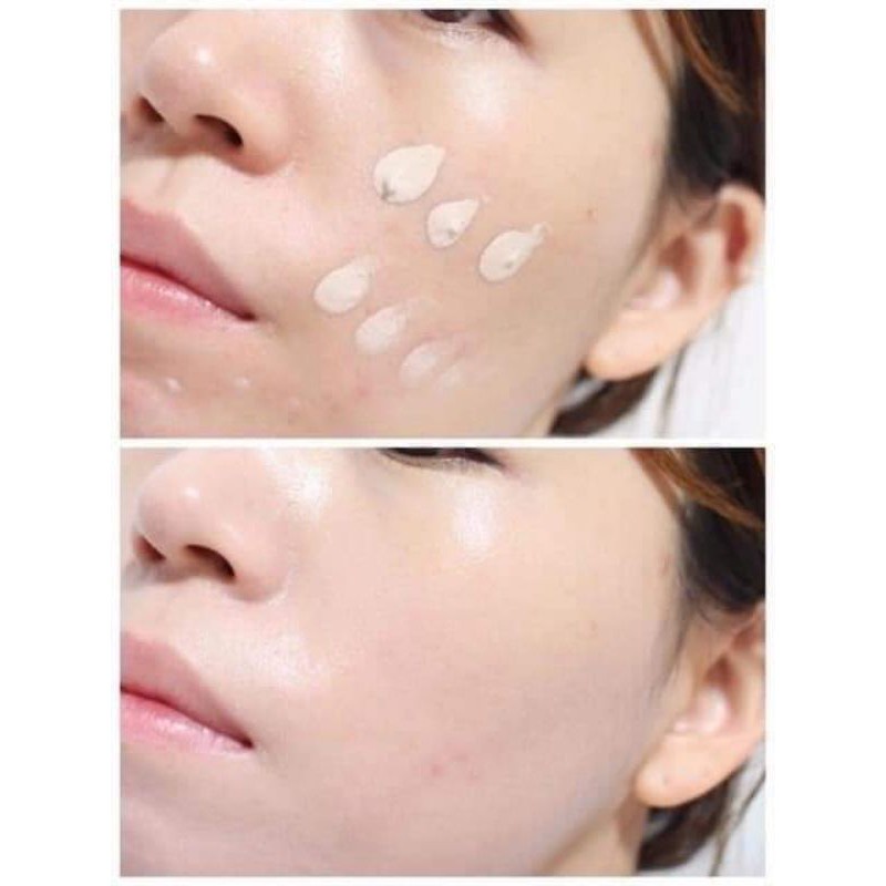 Kem dưỡng phục hồi, nâng tone Civasan H2O H20 Balmsam Blemish Balm và Meso Blemish Balm