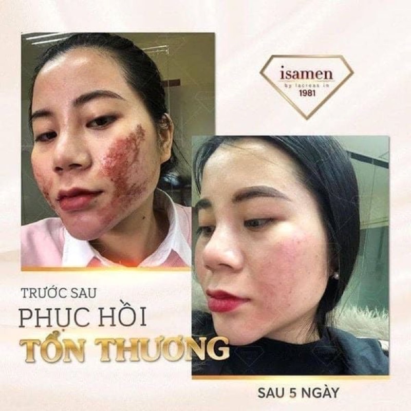 Tế Bào Gốc siêu phục hồi Isamen căng bóng , trắng da , làm dày da, làm lành vết thương sau peel lăn kim ..