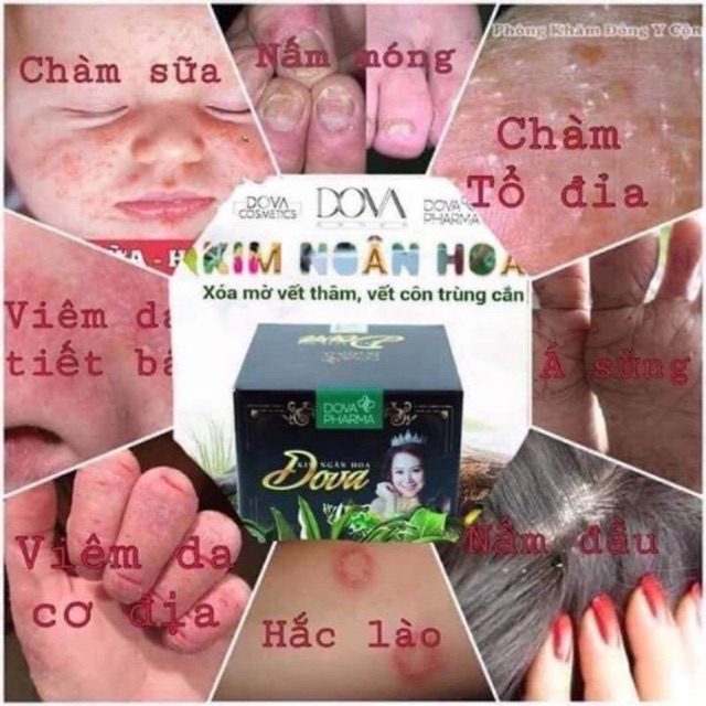 [Mã SRJULY1619 giảm 15K đơn 50K] Kim ngân hoa dova hàng chuẩn được kiểm tra hàng trước khi thanh toán | BigBuy360 - bigbuy360.vn