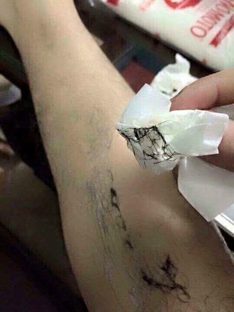 KEM TRIỆT LÔNG CCWHITE