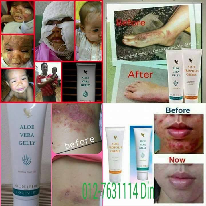 Combo 2 kem dưỡng da aloe vera gelly và aloe propolis