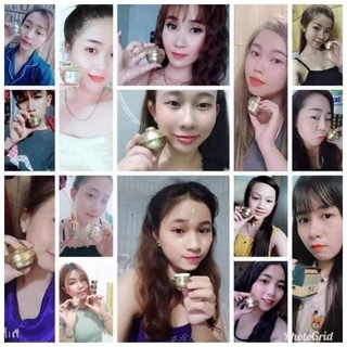 [ Kèm quà] Combo chuyên mụn Huỳnh Đỗ, sạch mụn hết thâm