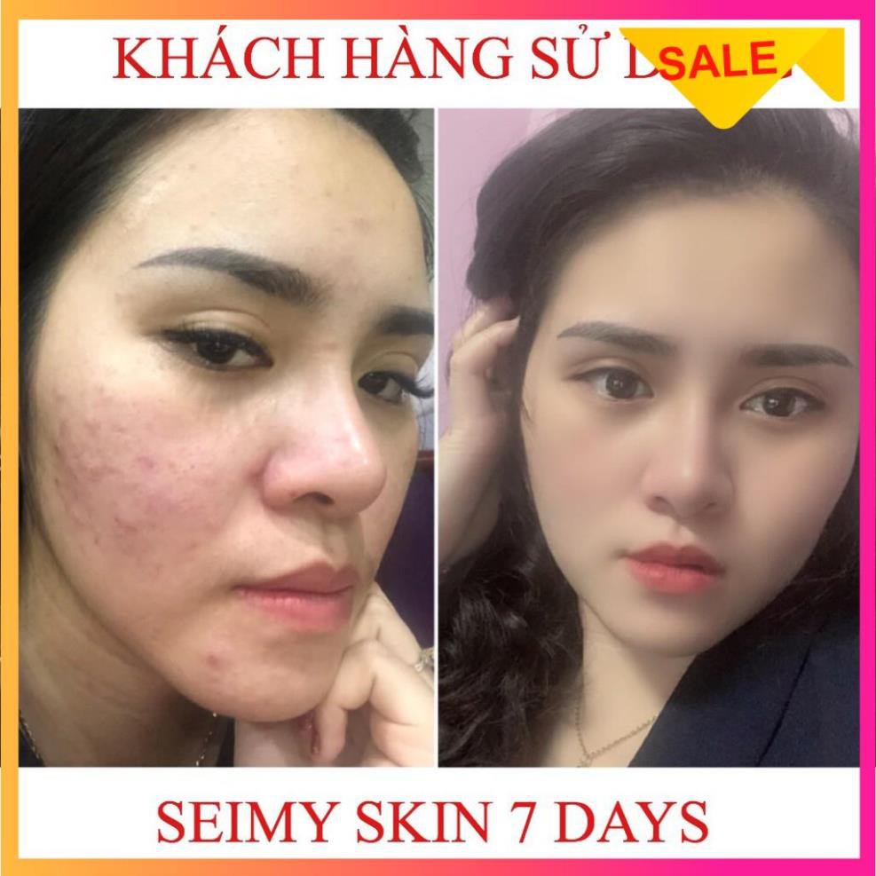 [SIÊU KHUYẾN MÃI] Serum giảm mụn thâm rỗ Seimy - Skin 7 Days | BigBuy360 - bigbuy360.vn