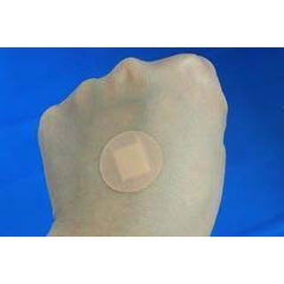 combo 100 Miếng dán Bandage sau cấy chỉ- Tiện lợi- An toàn TBYT NGUYỆT ANH