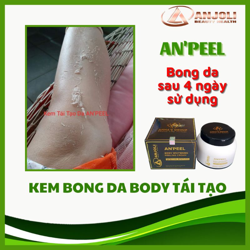 COMBO SỈ 5 KEM BONG DA BODY