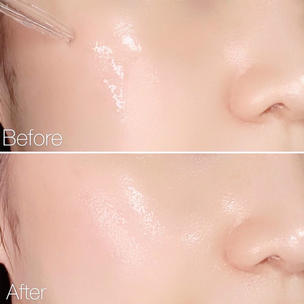 Serum Derladie Witch Hazel Perfect Vitamin Serum ngừa mụn, giảm thâm, làm đầy sẹo rỗ 35ml | BigBuy360 - bigbuy360.vn