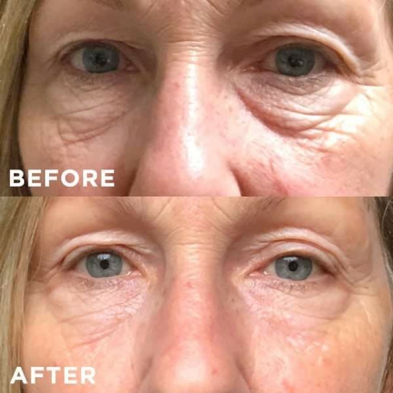 Tinh chất Peptide dưỡng da Matrixyl  giúp căng bóng, chống lão hoá da siêu hiệu quả