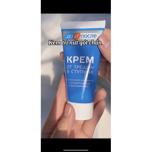 Kem Hỗ Trợ Cải Thiện Nứt Gót Chân Kpem Apteka Của Nga 50ml