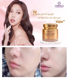 KEM COLLAGEN & INDEBENONE S+MIRACLE HÀN QUỐC 80ML