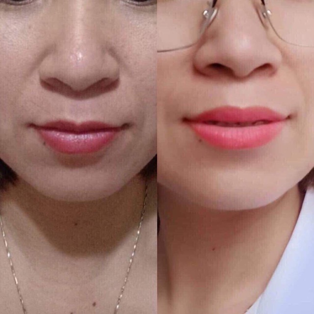 Dưỡng kích màu sau phun