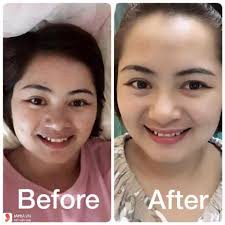 Mặt nạ nhau thai cừu Hàn Quốc giúp mờ nám, tàn nhang, trắng da - 1 hộp 6 miếng