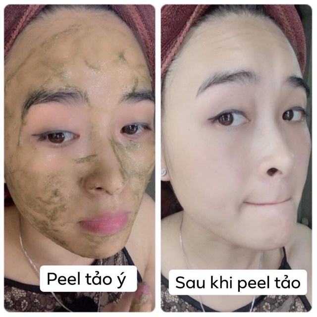 Peel Da Retinol Vi Tảo LE PEAU, Tinh Chất Tái Tạo Da Sinh Học, Căng Bóng [ CHÍNH - HÃNG - 100% ]