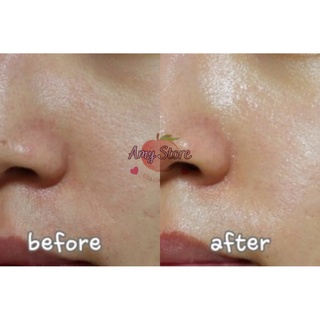 Kem dưỡng SKIN1004 MADAGASCAR CENTELLA