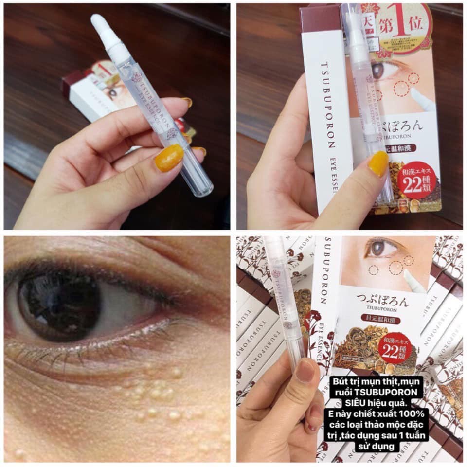 Kem Giảm Mụn Thịt Vùng Mắt Tsubuporon Eye Essence