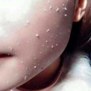 Tẩy da chết SPA mẫu mới