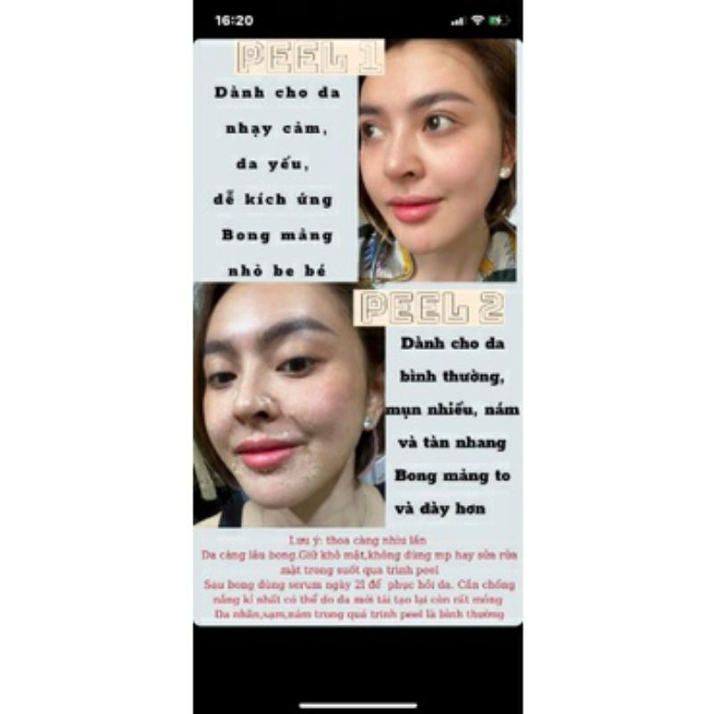 Peel da retinol vi tảo Trang Nemo