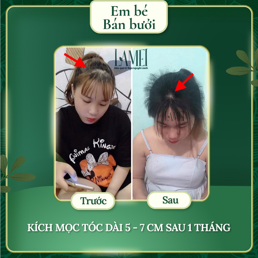 Tinh Dầu Bưởi Xanh Lamei 100 ml - Giúp Mọc Tóc - Em Bé Bán Bưởi