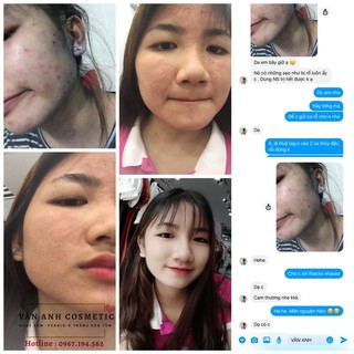 THANH LĂN MINI - NỬA LỌ NGỌC SÂM