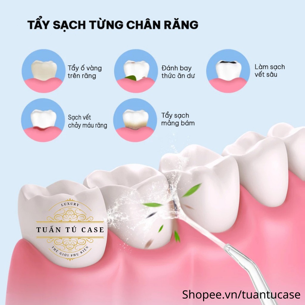 Máy tăm nước cầm tay Oral Irrigator làm sạch răng miệng linh hoạt nhỏ gọn tiện lợi