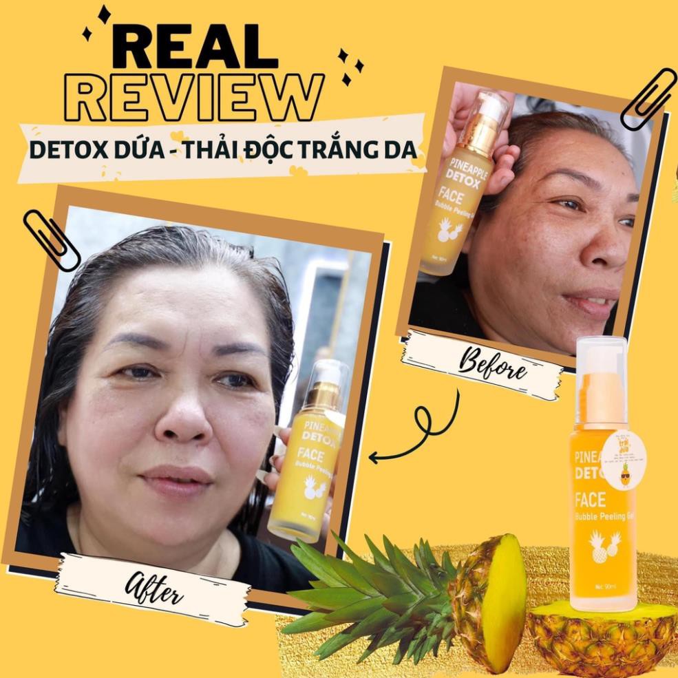 [Rẻ vô địch + Tặng Quà] Detox Dứa Queenie Skin - Detox Thải Độc Dứa Trắng Da Queenie Skin