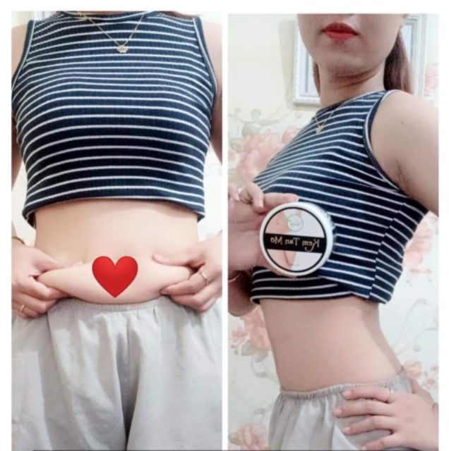Kem Tan Mỡ Cenly HÀNG CHÍNH HÃNG [tặng son kem cao câp] | BigBuy360 - bigbuy360.vn
