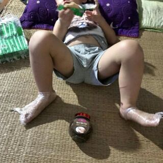 Bách nhi tán ( lọ to 180ml)