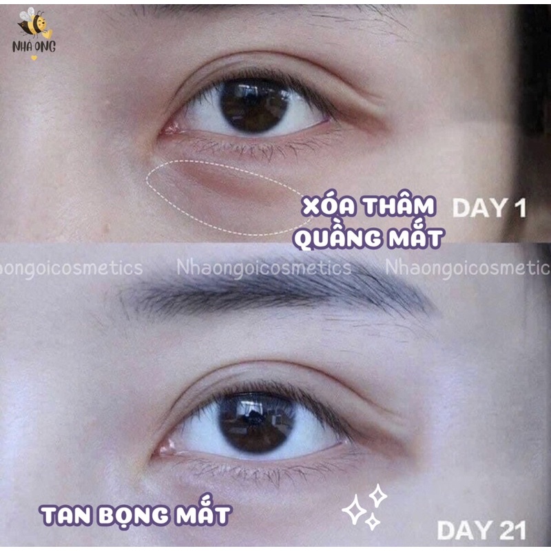 Kem Giảm Thâm Mắt Kumargic Eye Nhật Bản