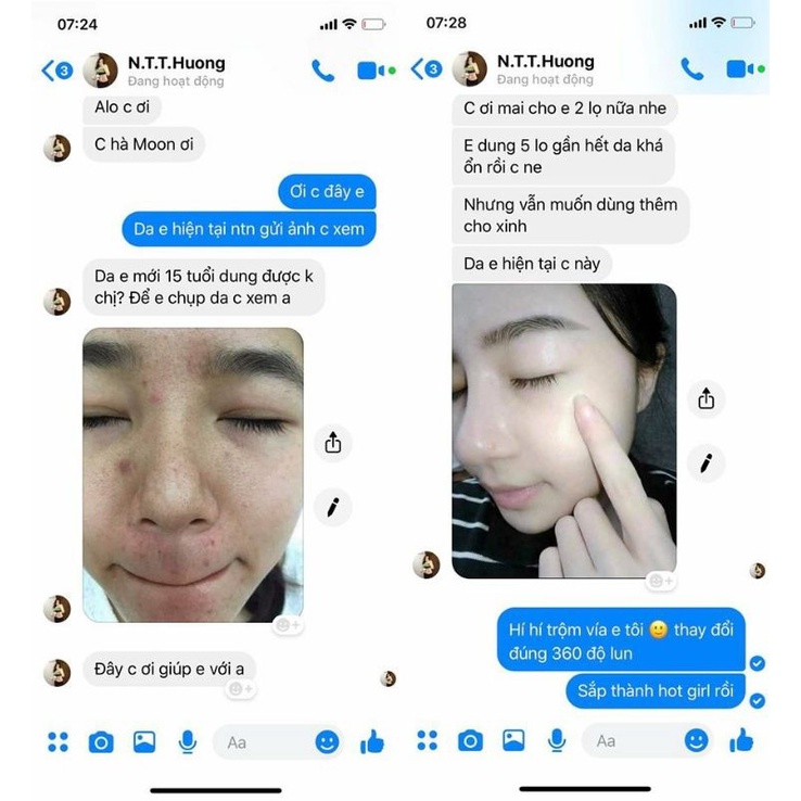 SERUM MỘC    TUYẾT | BigBuy360 - bigbuy360.vn