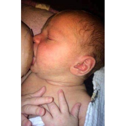 Núm trợ ti cho mẹ Hộp hỗ trợ đầu ti 2 chiếc ACuteBaby