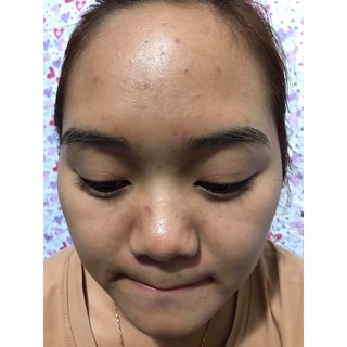 SERUM MỘC BEAUTY
