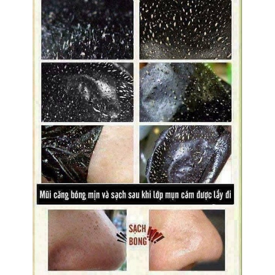 Gel hút mụn Cosy White 50g lột mụn than tre hoạt tính tẩy sạch bã nhờn se khít lỗ chân lông