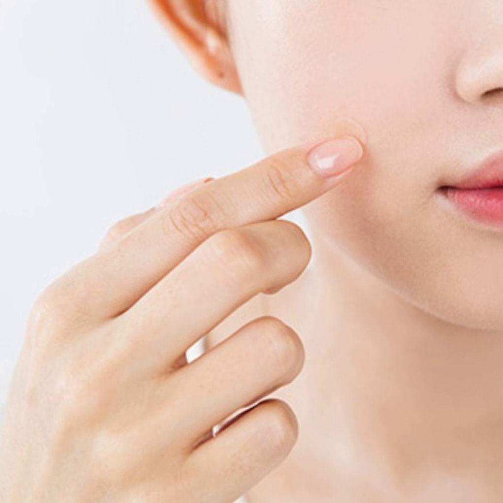 Miếng dán che mụn, mủ và hỗ trợ làm lành vết thương Neoderm L – Hàn Quốc, Hộp 16 miếng 12mm