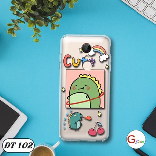 Ốp lưng dẻo Xiaomi Redmi 5