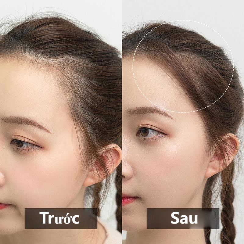 Phấn che khuyết điểm tóc SUAKE dành cho đầu hói, bò liếm, tóc thưa nội địa Trung