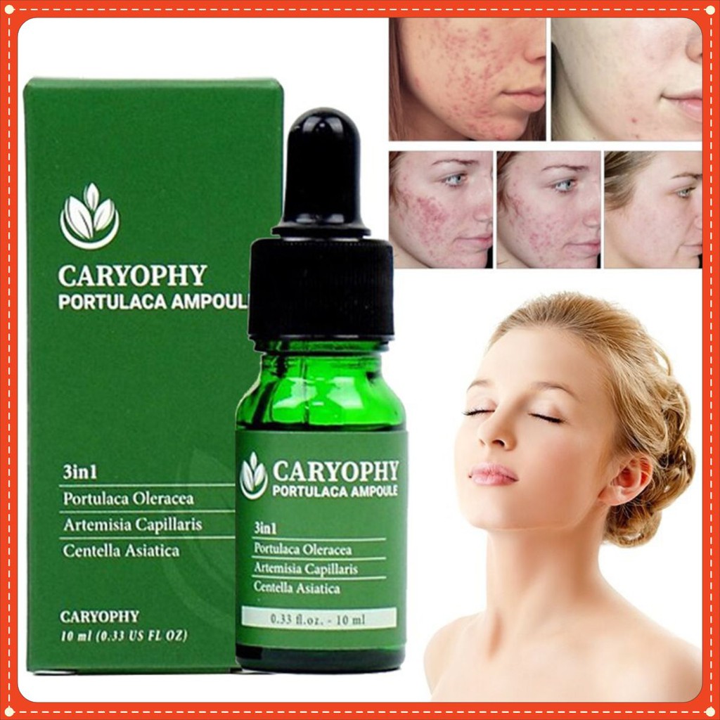 Serum Giảm mụn caryophy 10ml