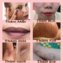 Thâm jiuhe bye bye melano