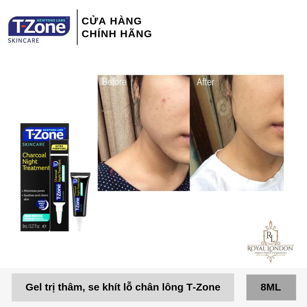 Combo Gel Giảm Mụn T-Zone Zapping Gel 8ml Và Gel GiảmThâm T-Zone Charcoal Night Treatment 8ml - UK