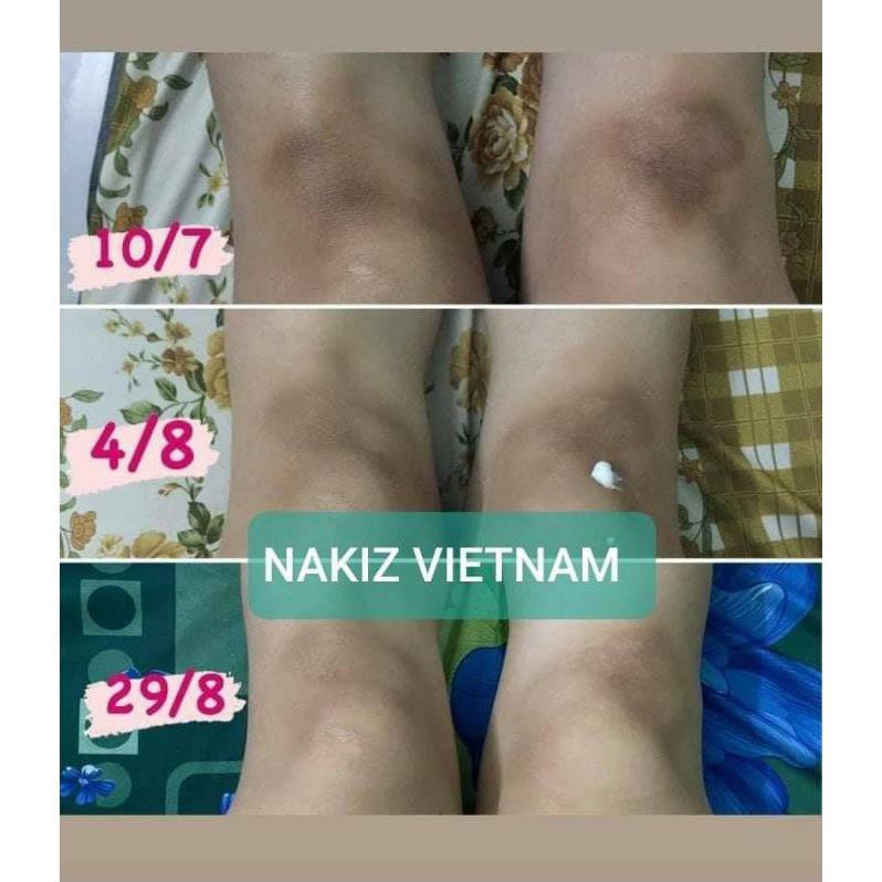 2 TUÝP NAKIZ LIVELY BUTT 〡 Kem thoa thâm Mông, Bẹn, Nách, Lưng, Nhũ hoa, Đầu gối, Cùi chỏ.... Thái Lan | BigBuy360 - bigbuy360.vn