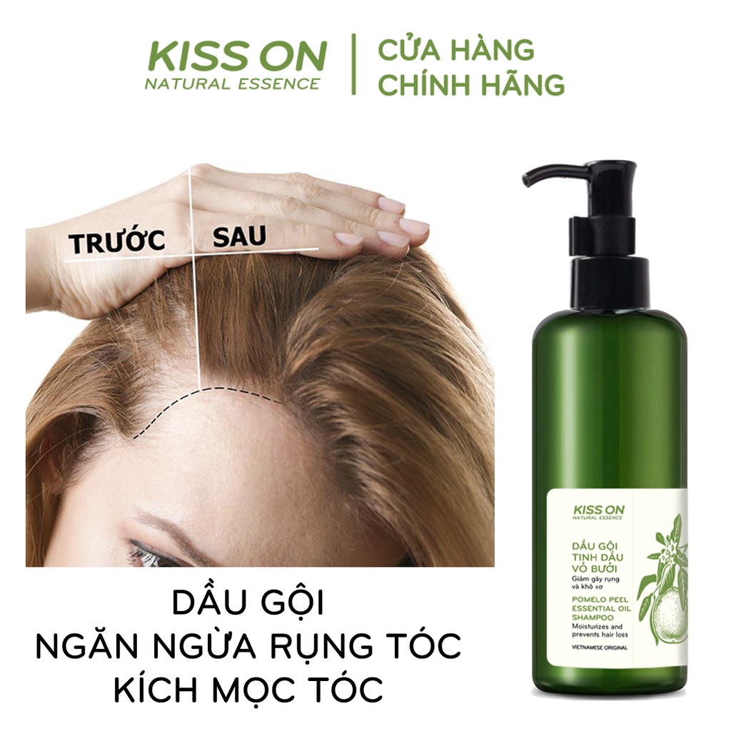 Dầu gội đầu tinh dầu vỏ bưởi KISS ON 300 ml giúp ngăn ngừa rụng tóc, kích mọc tóc, giúp tóc suôn mượt tự nhiên