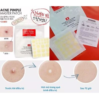 Miếng dán mụn Cosrx Master Patch 24 miếng hút mủ tốt