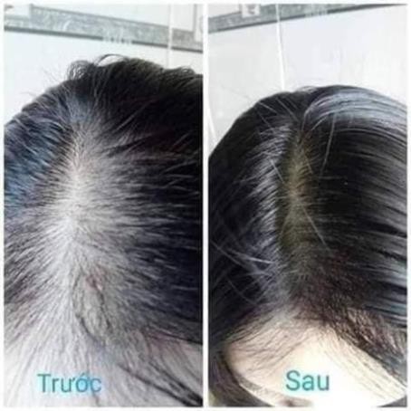 [ giá tốt nhất] [100% không hóa chất ] Bộ dầu gội xả 2in1 + ủ dưỡng tóc + xịt mọc tóc thảo dược organic GREENBON